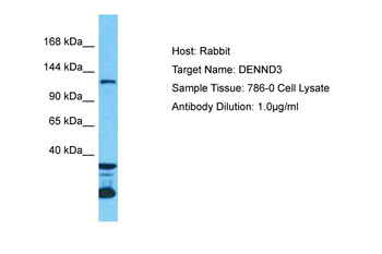 DENND3 Rabbit Polyclonal Antibody