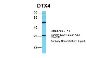 DTX4 Rabbit Polyclonal Antibody