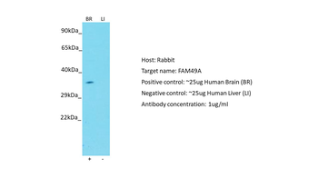 FAM49A Rabbit Polyclonal Antibody