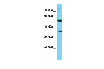 FAM49A Rabbit Polyclonal Antibody