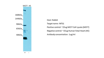 INTS1 Rabbit Polyclonal Antibody