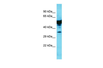 Krt35 Rabbit Polyclonal Antibody
