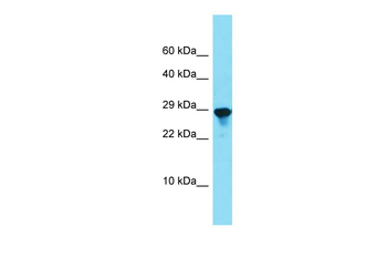 Spcs2 Rabbit Polyclonal Antibody