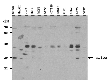 RRP15 Rabbit Polyclonal Antibody