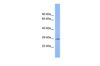 C6orf203 Rabbit Polyclonal Antibody