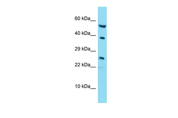 RAB42 Rabbit Polyclonal Antibody