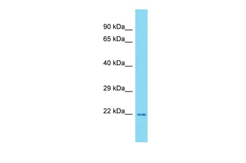 RTKN2 Rabbit Polyclonal Antibody