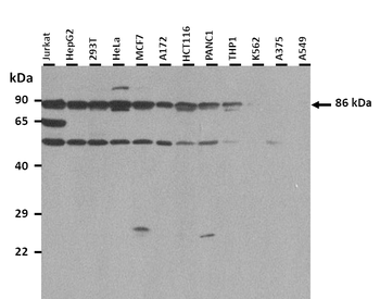 ZYG11A Rabbit Polyclonal Antibody