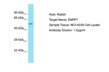 ENPP7 Rabbit Polyclonal Antibody