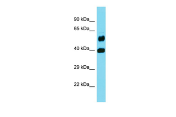 FOLH1B Rabbit Polyclonal Antibody