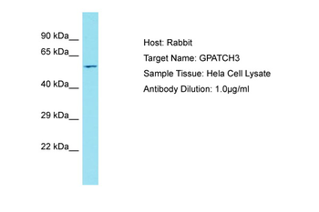 GPATCH3 Rabbit Polyclonal Antibody