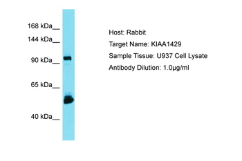 VIRMA Rabbit Polyclonal Antibody