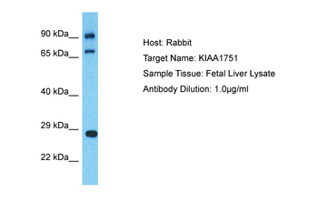CFAP74 Rabbit Polyclonal Antibody