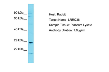 LRRC38 Rabbit Polyclonal Antibody