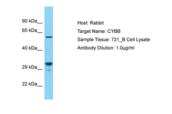 CYBB Rabbit Polyclonal Antibody