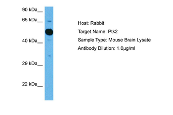 PTK2 Rabbit Polyclonal Antibody