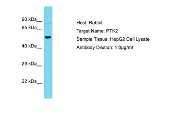 PTK2 Rabbit Polyclonal Antibody