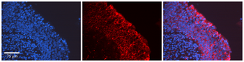 PTK2 Rabbit Polyclonal Antibody