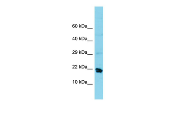 MRPS25 Rabbit Polyclonal Antibody