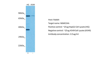 NSMCE4A Rabbit Polyclonal Antibody