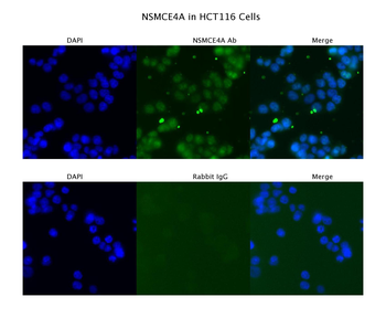 NSMCE4A Rabbit Polyclonal Antibody
