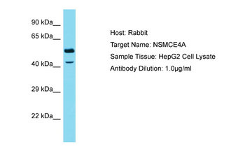NSMCE4A Rabbit Polyclonal Antibody