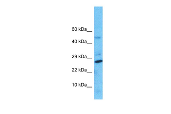 NUDT8 Rabbit Polyclonal Antibody