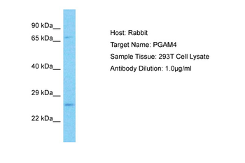 PGAM4 Rabbit Polyclonal Antibody