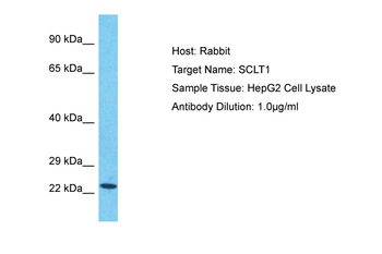 SCLT1 Rabbit Polyclonal Antibody