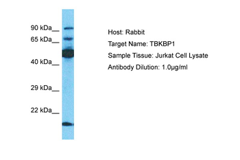 TBKBP1 Rabbit Polyclonal Antibody