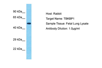TBKBP1 Rabbit Polyclonal Antibody