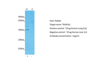 TRIM16L Rabbit Polyclonal Antibody