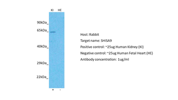 SHISA9 Rabbit Polyclonal Antibody