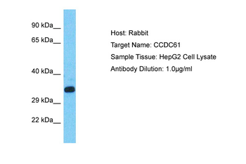 CCDC61 Rabbit Polyclonal Antibody