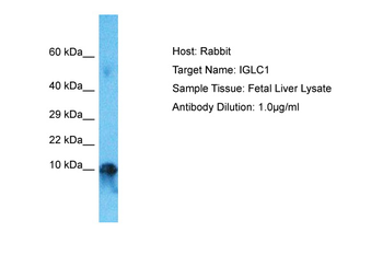 IGLC7 Rabbit Polyclonal Antibody