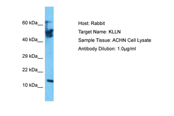 KLLN Rabbit Polyclonal Antibody