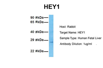 HEY1 Rabbit Polyclonal Antibody