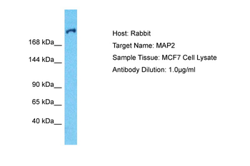 MAP2 Rabbit Polyclonal Antibody