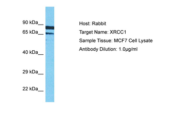 XRCC1 Rabbit Polyclonal Antibody