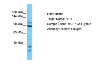 HIP1 Rabbit Polyclonal Antibody