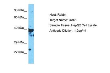 OAS1 Rabbit Polyclonal Antibody