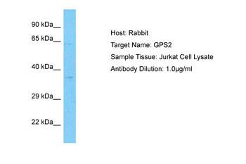 GPS2 Rabbit Polyclonal Antibody