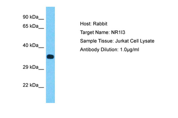 NR1I3 Rabbit Polyclonal Antibody