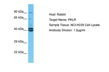 PKLR Rabbit Polyclonal Antibody