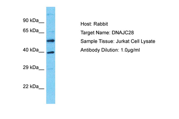 DNAJC28 Rabbit Polyclonal Antibody
