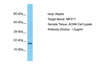 MPV17 Rabbit Polyclonal Antibody