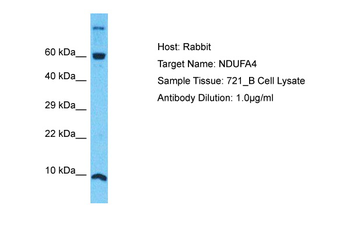 NDUFA4 Rabbit Polyclonal Antibody