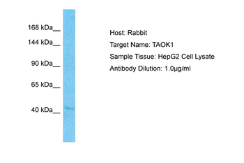 TAOK1 Rabbit Polyclonal Antibody