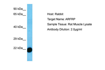 Arfrp1 Rabbit Polyclonal Antibody