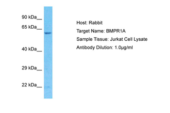 BMPR1A Rabbit Polyclonal Antibody